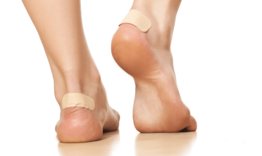 A view of a person's blistered heels treated correctly with plasters.